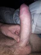 Posted A Shot Pulled Back Earlier, Now With My Foreskin Up, Which Is Better...? Vote ...