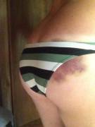 My Bikini Doesn't Have A Snowball's Chance In Hell O(F) Covering Sir's Marks, He's ...