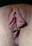 Not Sure About My Labia... What Do You Think?