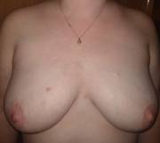 F31, 5'2&Amp;Quot;, (Not Sure Of Weight) Here's My Boobs How They Normally Lay.