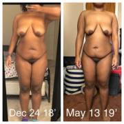 F/21/158# My Before Is 167#, It’s Been A Slow Process. I See Small Changes But ...