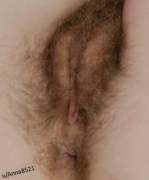 So Guys, The Soft Pubic Hairs Around My Anus. I Used To Shave/Wax Them Off, Now I ...