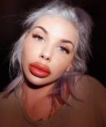 Lips The Size Of Her Face For Swedish Bimbo Sindyniklasson