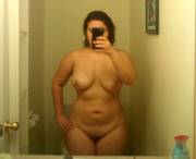 20/F/180Lbs/5Ft0  - Si Burn Scars, Overweight. Hate Being Naked - Do I Really Have ...