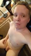 25 M, 167 Lbs And I Have Spina Bifida. I've Never Felt Normal, Likeable Or Attractive. ...