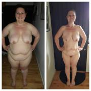 Nsfw [F/34/5'7 - 352 -&Amp;Amp;Gt; 202 Lbs] My Body After I Lost Weight. I Have Flaws, ...