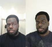M/26/6'3 [346-309Lbs = 37Lbs/1Yr] Years Of Depression, Mid 20S Male Pattern Baldness, ...