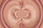 Vaginal Symmetry
