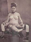 Prostitute With 4 Boobs 2 Vaginas And 3 Legs. Her Name Was Blanche Dumas. Nsfw [X-Post ...