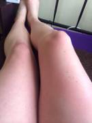 My Creamy Legs With A Light Touch Of Sunburn. Oh And A Little Spread Of Cute Freckles ...