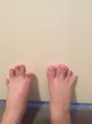 I Did A Quick Manipulation Of My Feet Turning Into Hooves. It's Amateurish, But I ...